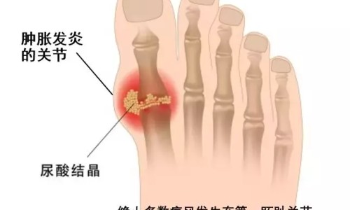 球蟒体型-6个月球蟒多长网-分享球蟒能多重，球蟒有牙齿吗知识库
